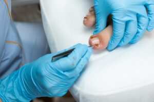 Podóloga realizando una pedicura médica en cabina